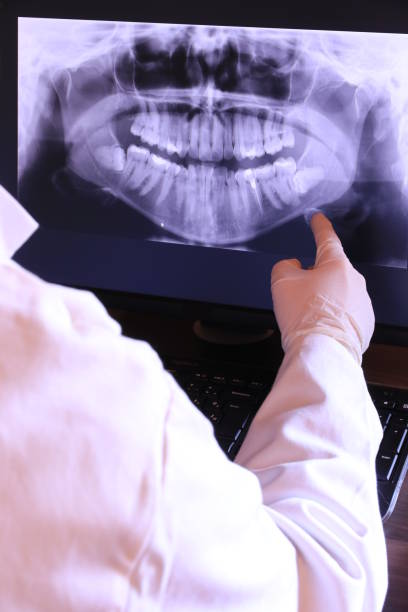 Best Tooth Infection Emergency Dentist  in Yucos, CA