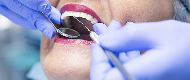 Best Dentist for Tooth Abscess  in Yucos, CA